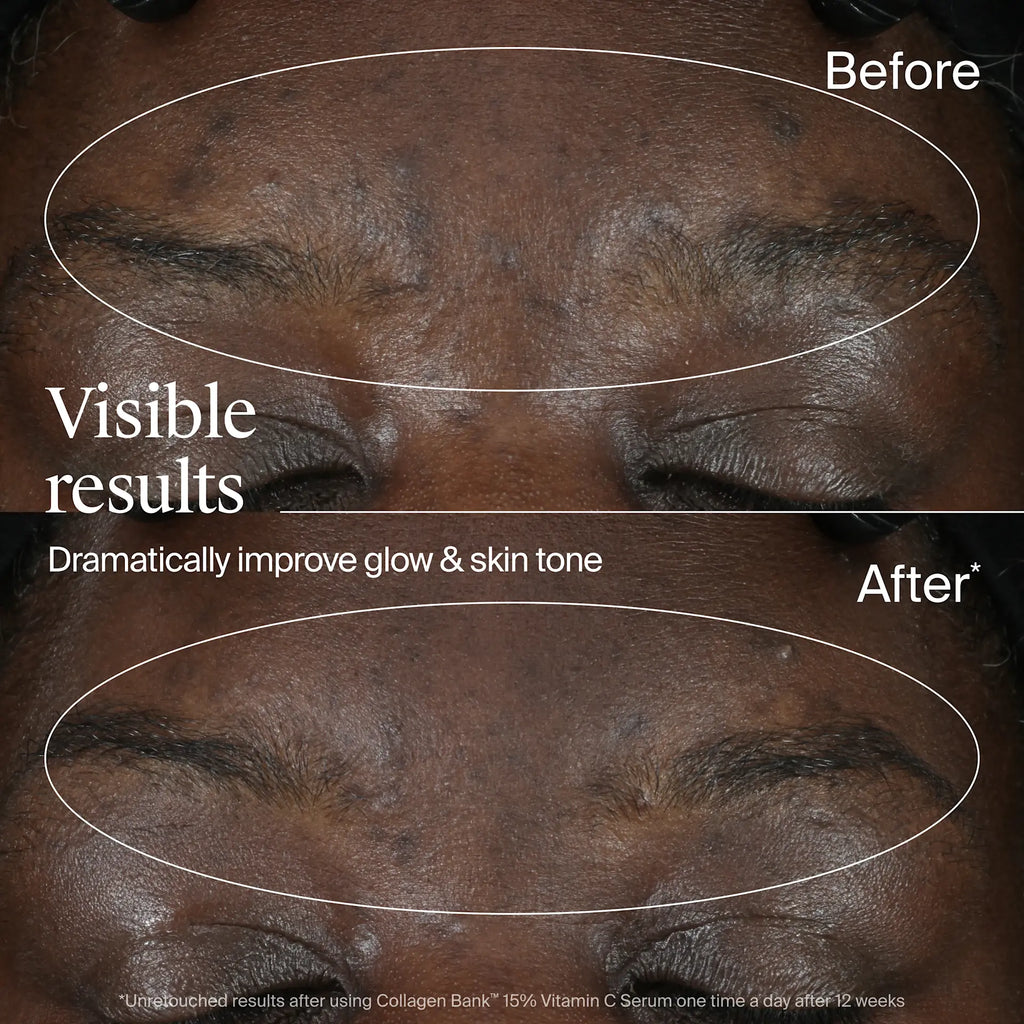 Neutrogena® Collagen Bank 15% Vitamin C Glow Serum, 0.5 Fl. Oz