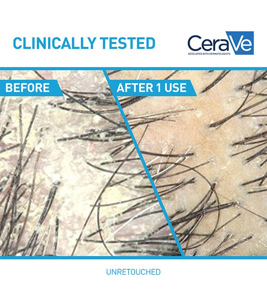 Anti-Dandruff Hydrating Shampoo