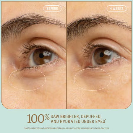 Squalane + 5% Niacinamide Brightening Eye Serum